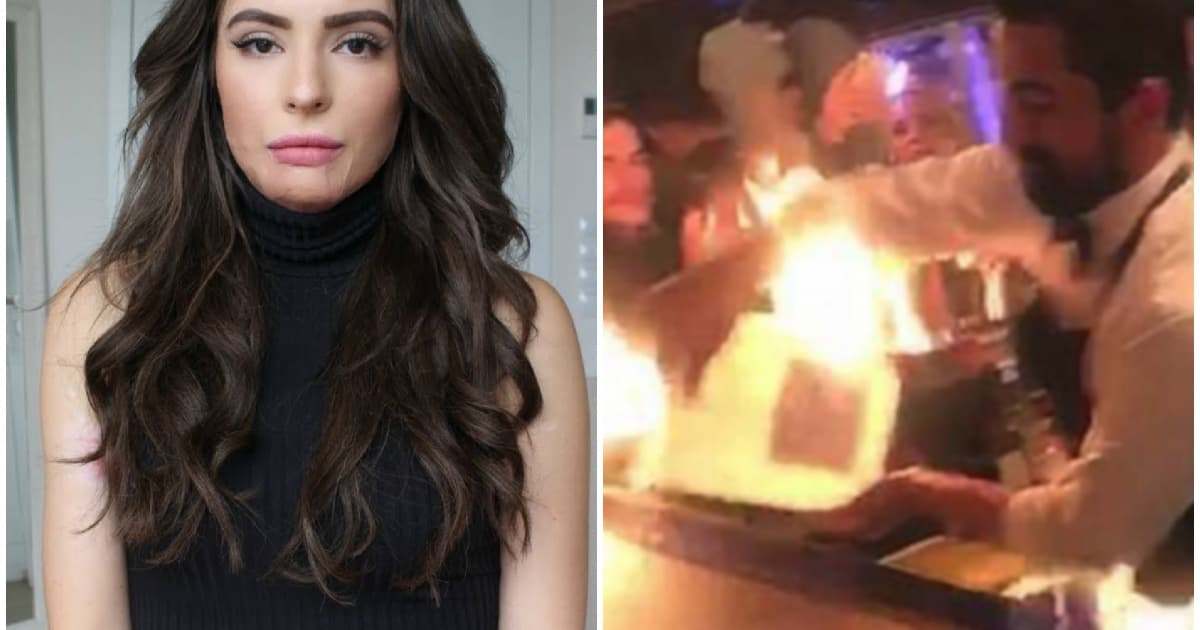 Česká vlogerka po prvýkrát ukázala popáleniny a otvorene popísala nešťastný incident