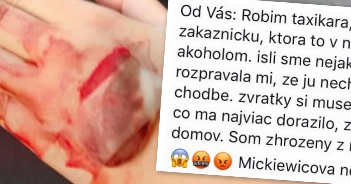 Slová tohto taxikára doslova mrazia. Takto viezol ženu z nemocnice